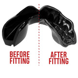 SAFEJAWZ chrániče zubů Intro Black Senior, SJBLACKa