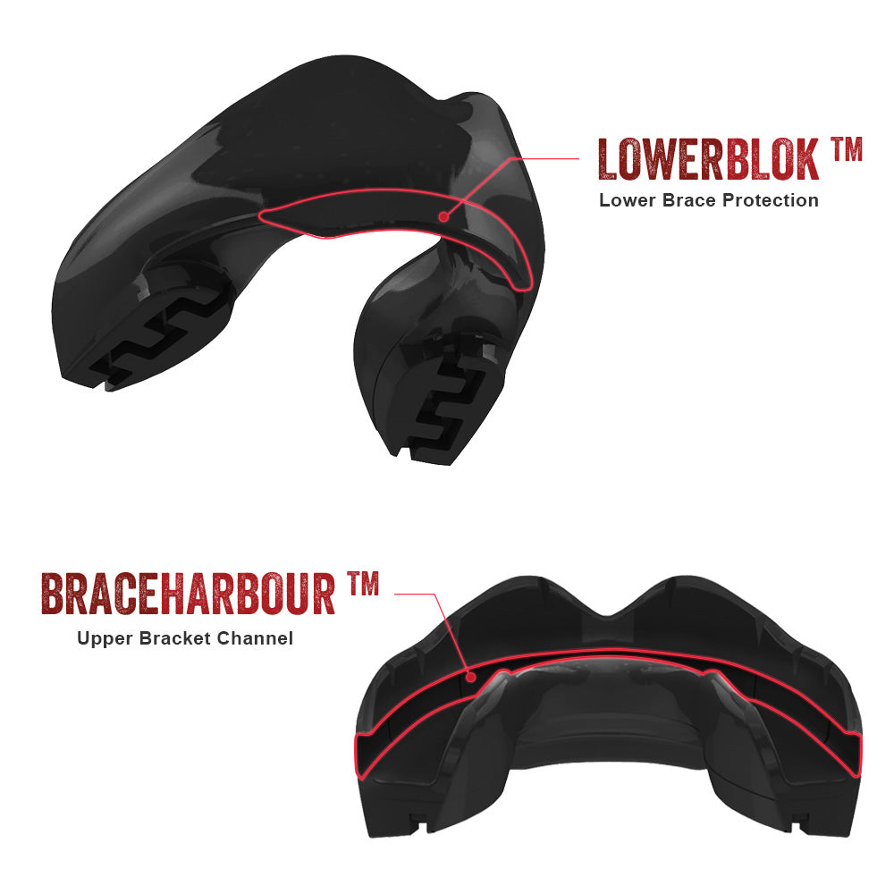 SAFEJAWZ Ortho chrániče zubů na rovnátka, černá/senior